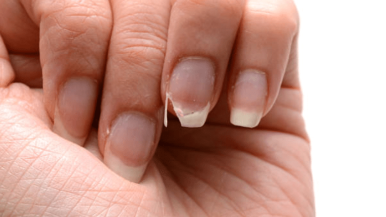 comment fortifier des ongles mous