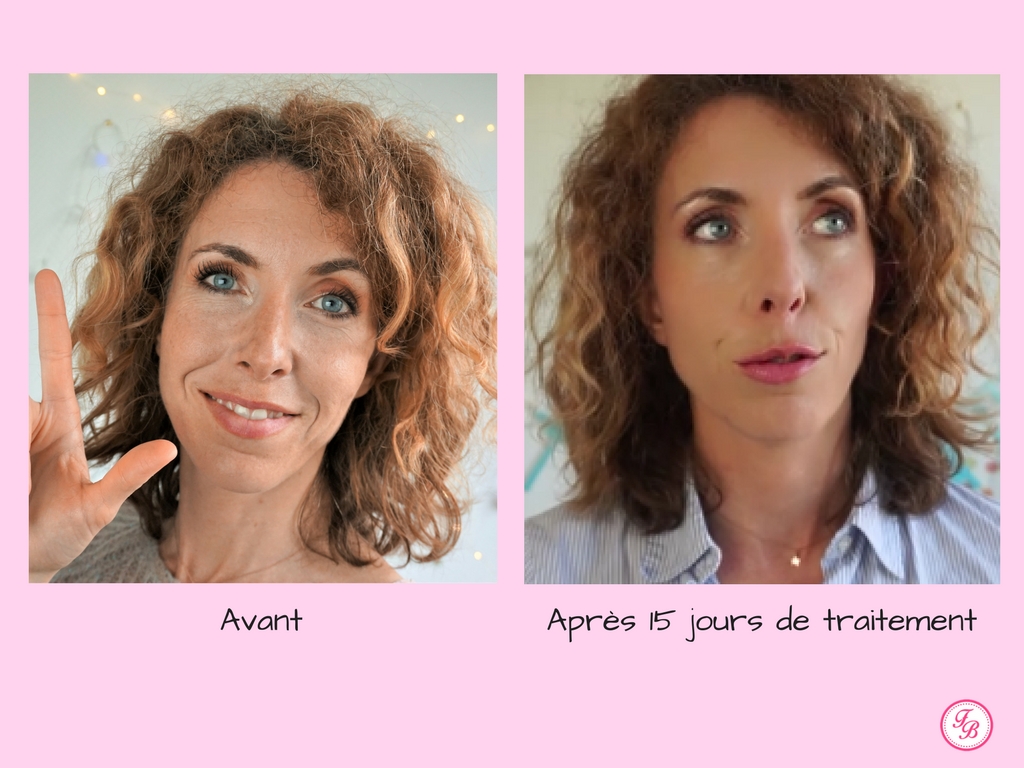 quelles sont les gelules autobronzantes les plus efficaces